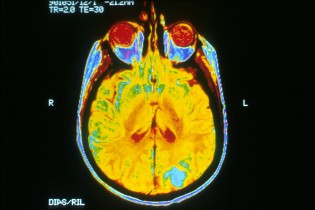 Мрт мозга. Цветная томограмма мозга. Цветное мрт. Снимки мрт цветные. MRI Brain scan.